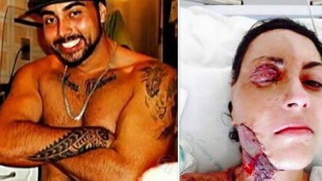 Após 224 cirurgias, jovem pede que ex que matou seus filhos não seja solto; foto é forte