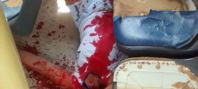 Ao colocar a cabeça pra fora do Ônibus, jovem tem a cabeça decepada