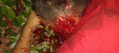 Imagnes Fortes! Homem é torturado e morto com dez tiros de pistola 9 mm