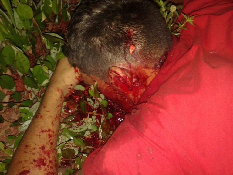 Imagnes Fortes! Homem é torturado e morto com dez tiros de pistola 9 mm