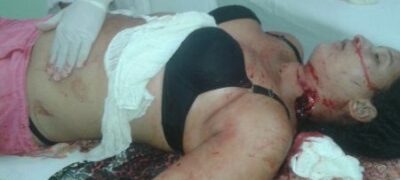 Imagens Fortes! Mulher grávida de 8 meses é morta a facadas pelo marido