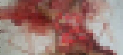 Imagens Fortes! Ex-marido flagra mulher com namorado e mata os dois a facadas