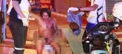 Mulher tenta arrancar pênis do marido com faca após traição com melhor amiga