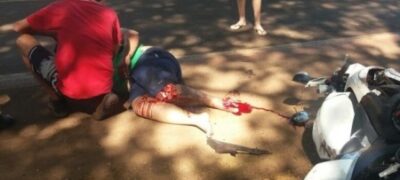 Jovem tem perna arrancada após colisão entre duas motos em Dourados