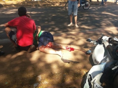 Jovem tem perna arrancada após colisão entre duas motos em Dourados