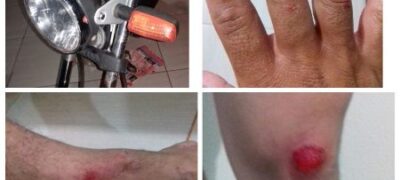 Em Bela Vista, vaca solta em pista causa acidente