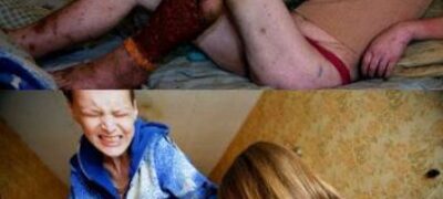 Droga que mata em 3 dias chega ao Brasil, a droga do apocalipse, assista aqui