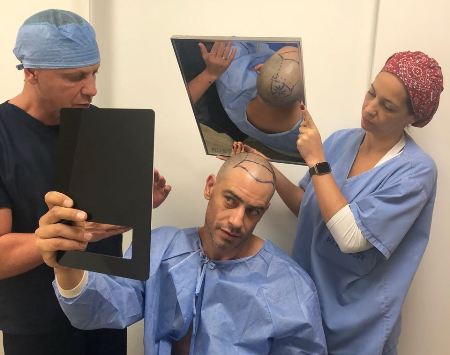 Após perder vários papéis em novelas devido a calvície, ator Diego Cristo se submete a transplante capilar