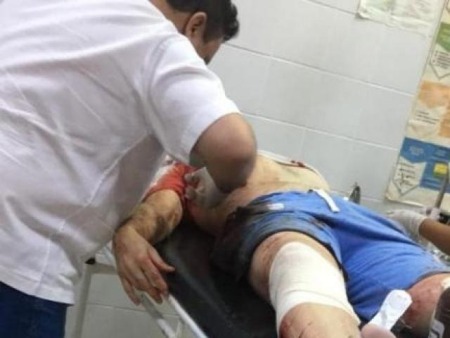 Tiros de fuzil deixa ferido ex jogador da seleção de Bela Vista