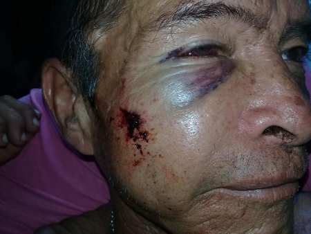 Dois casos de agressão contra idosos em Murtinho revolta a população fronteiriça