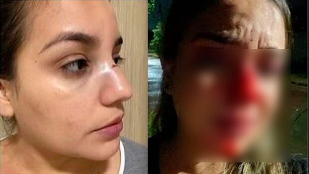 Vítima desaba com liberdade de ex-assessor político: ‘ainda quer tirar meu filho de mim’