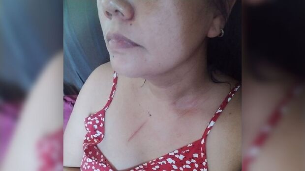 Vereadora é surrada pelo irmão em Ivinhema; mãe aciona PM