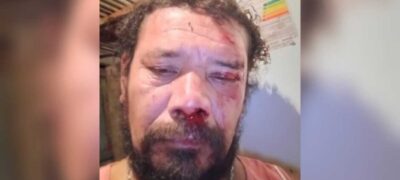 “Estou todo dolorido”, diz homem atacado por onça ao tentar defender cachorro em Corumbá