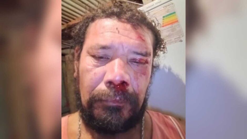 “Estou todo dolorido”, diz homem atacado por onça ao tentar defender cachorro em Corumbá