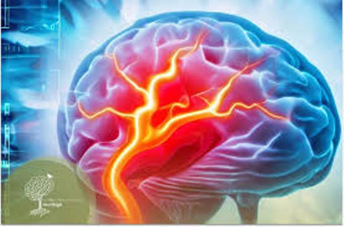 A cada 40 segundos, alguém sofre um AVC. Saber como reagir pode fazer a diferença