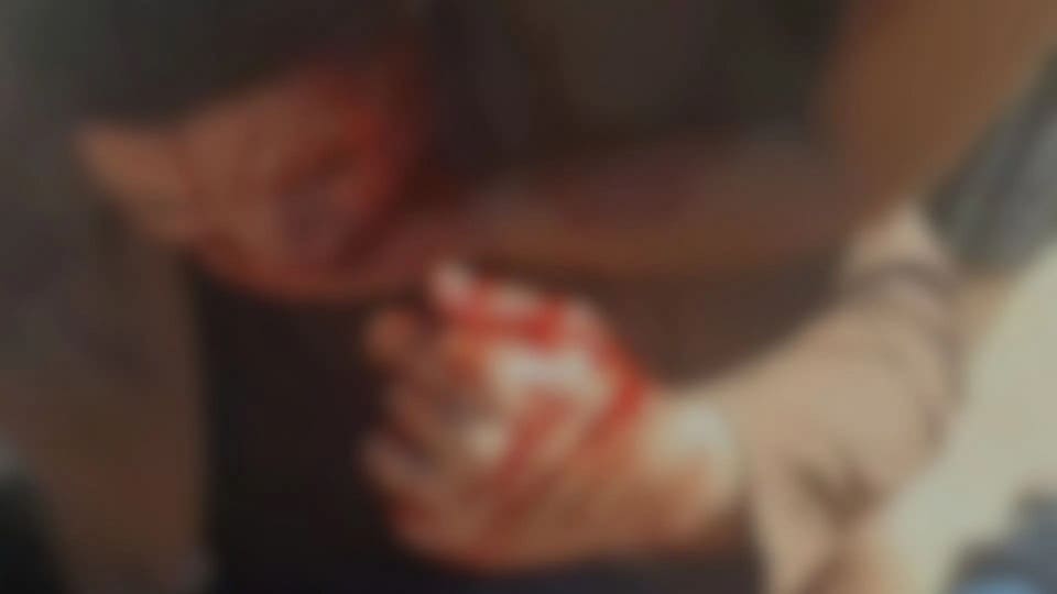 Jornalista é agredido a pauladas após sair de evento da Prefeitura de Três Lagoas