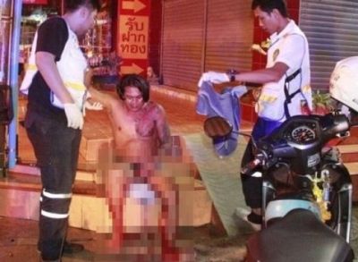Mulher tenta arrancar pênis do marido com faca após traição com melhor amiga