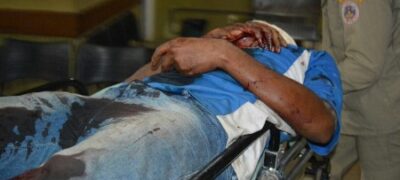 Trabalhador rural fica gravemente ferido ao receber golpes de foice na cabeça