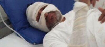 Morador de MS é torturado e marcado com ferro quente no Paraguai