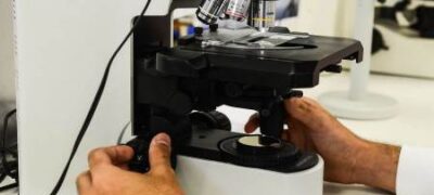 Brasileira desenvolve novo tratamento para câncer de ovário