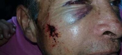 Dois casos de agressão contra idosos em Murtinho revolta a população fronteiriça