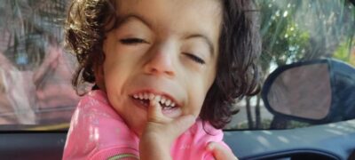 Maria Valentina tem uma síndrome rara e pede ajuda pela plataforma Donativa