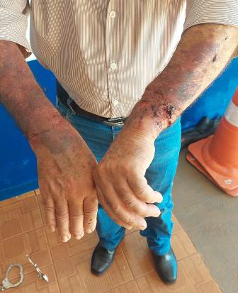 Taxista é assaltado, torturado e deixado algemado em árvore na fronteira