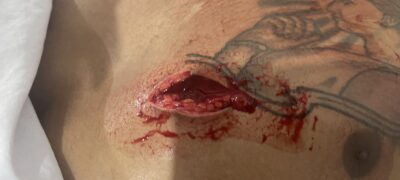 Três pessoas são esfaqueadas durante briga em baile em Porto Murtinho.