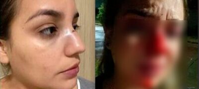 Vítima desaba com liberdade de ex-assessor político: ‘ainda quer tirar meu filho de mim’