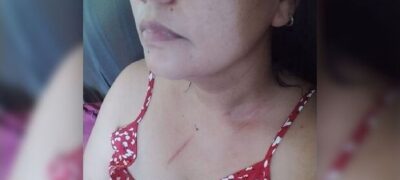 Vereadora é surrada pelo irmão em Ivinhema; mãe aciona PM
