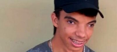 Jovem com síndrome rara cria vaquinha para arrecadar dinheiro para fazer cirurgia 