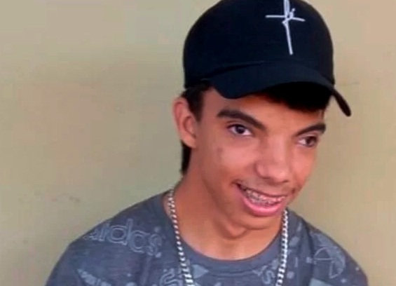 Jovem com síndrome rara cria vaquinha para arrecadar dinheiro para fazer cirurgia 