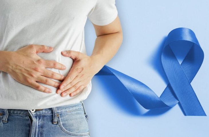 Março Azul: SES apoia campanha de prevenção e diagnóstico precoce do câncer de intestino