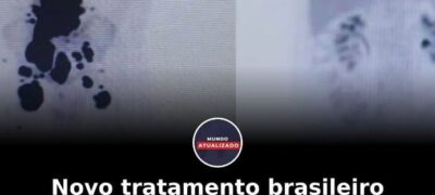 Novo tratamento brasileiro reduz câncer em 87% e recebe investimento milionário do governo