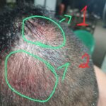 Vítima de suposto ataque na Colônia Ingazeira se identifica e relata novas informações sobre o caso