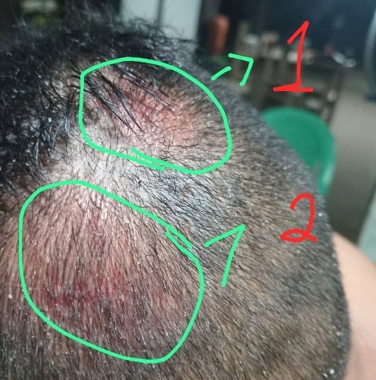 Vítima de suposto ataque na Colônia Ingazeira se identifica e relata novas informações sobre o caso