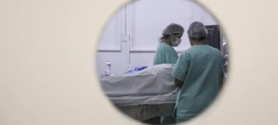 Câncer: estudo alerta para riscos de melanoma fora da pele